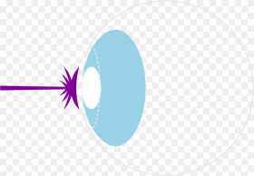 Transparent Laser Eye Surgery Clipart Circle Png